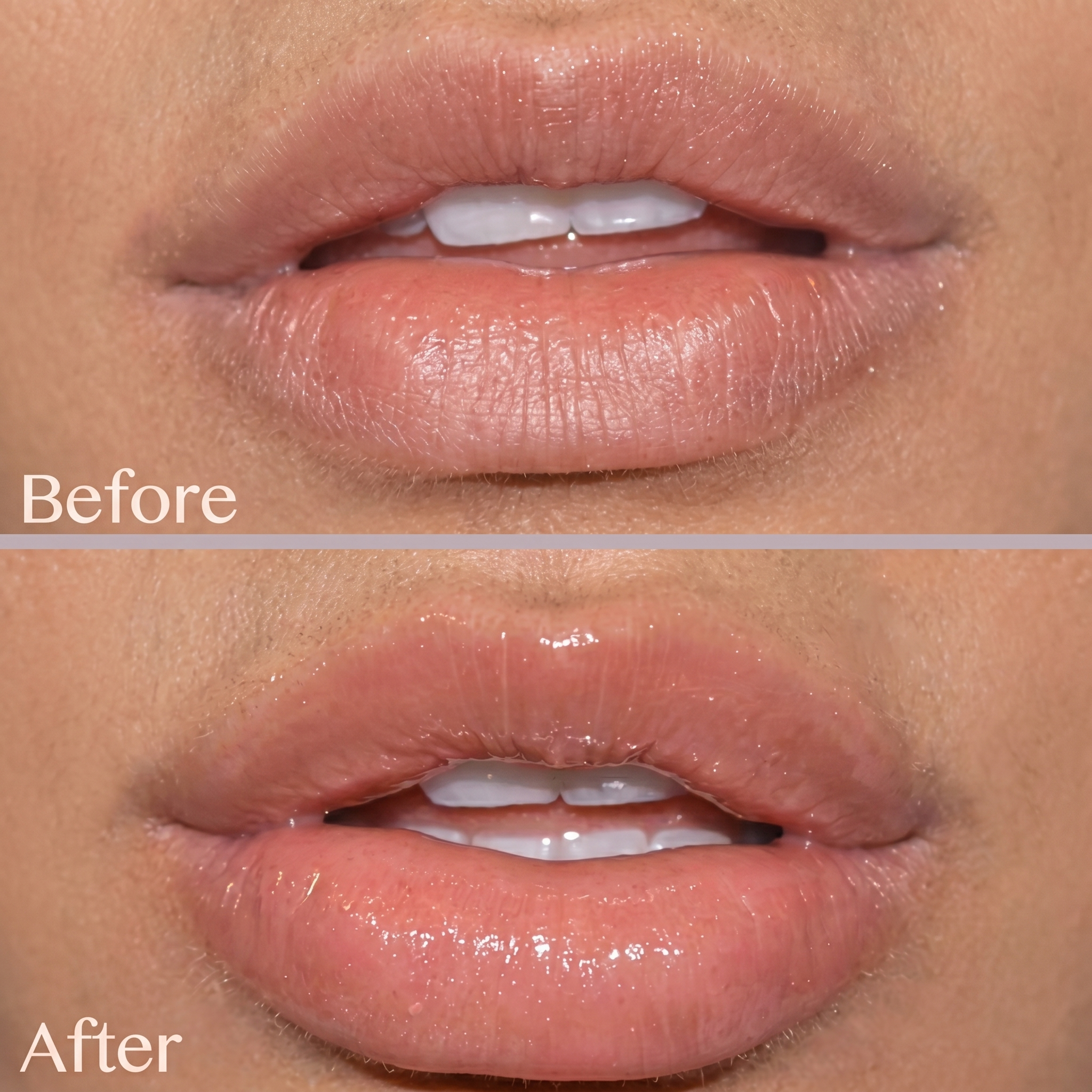 Long Lasting Lip Plumper