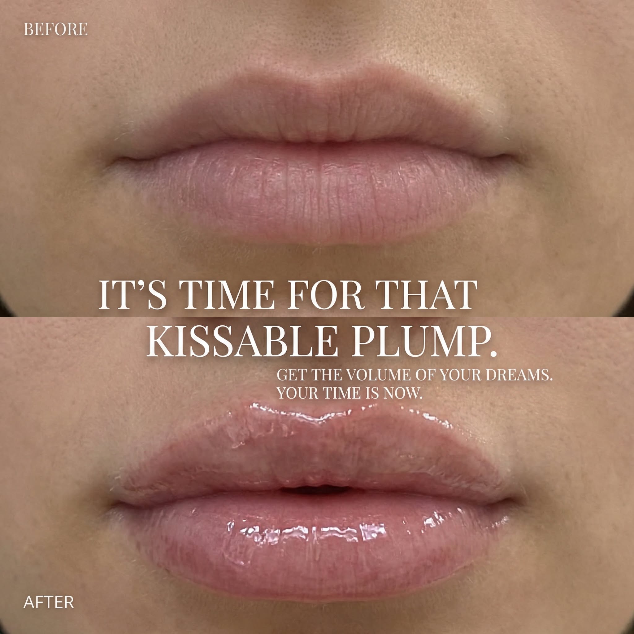 Long Lasting Lip Plumper
