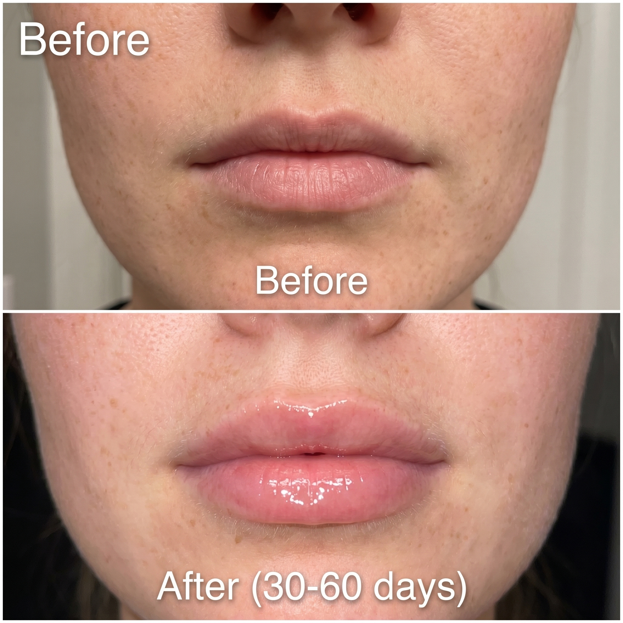 Long Lasting Lip Plumper